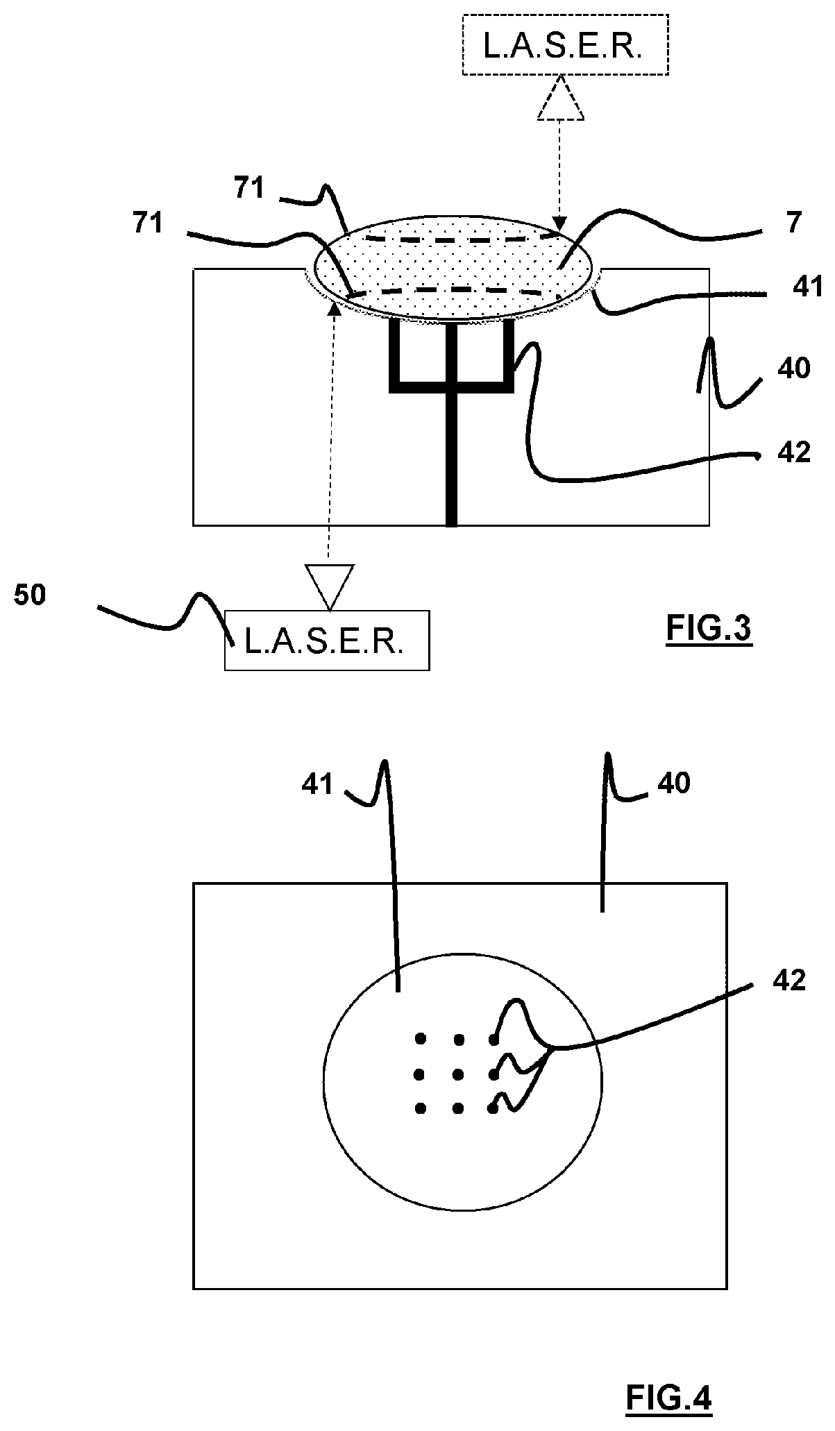 Method for preparing an allograft or xenograft material from a crystalline lens capsule