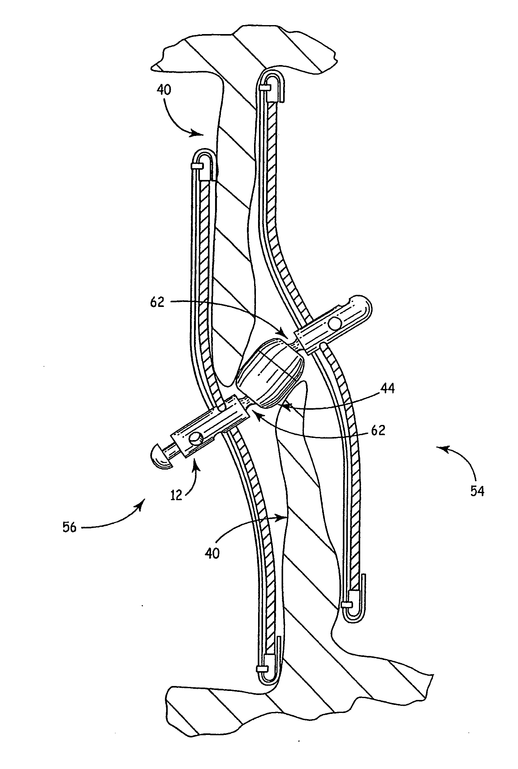 Articulated center post