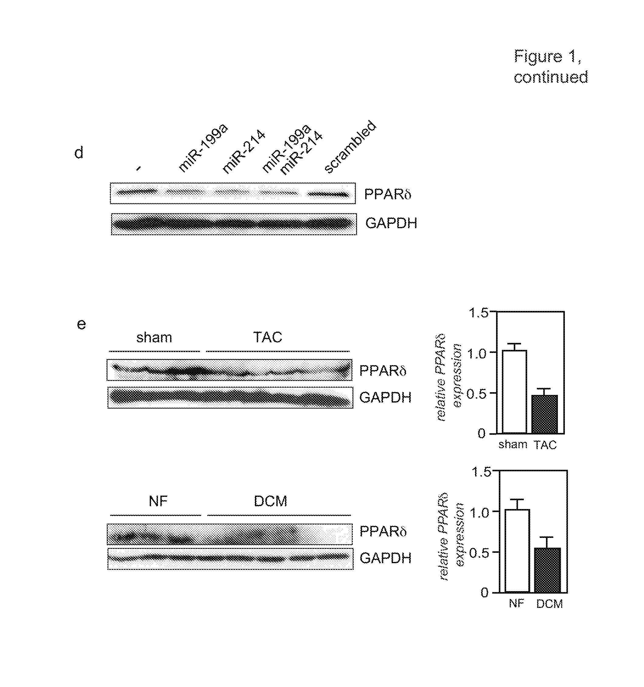 Means and methods for counteracting, delaying and/or preventing adverse energy metabolism switches in heart disease