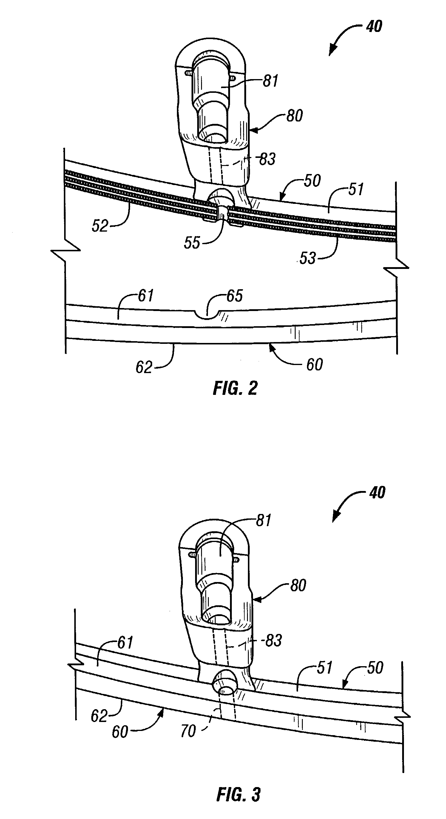 Infusion clamp