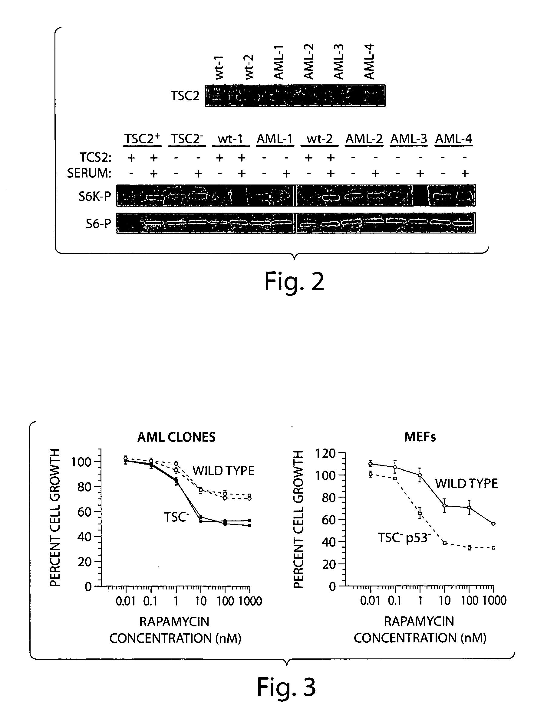 Immortalized human Tuberous Sclerosis null angiomyolipoma cell and method of use thereof