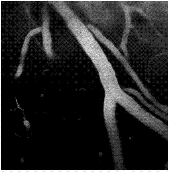 Vascular image processing method based on circular contour polarity