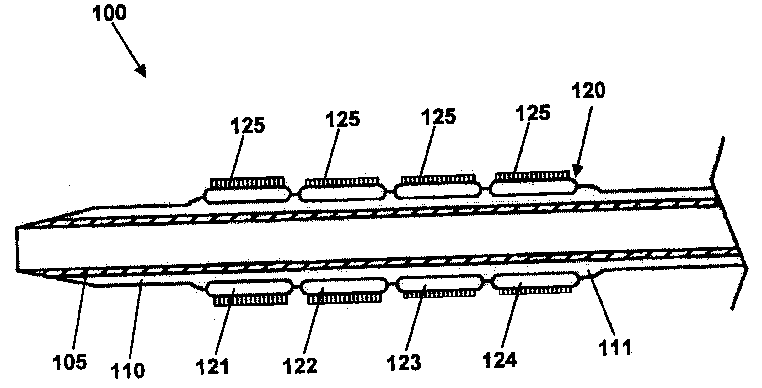 Stent with detachable ends