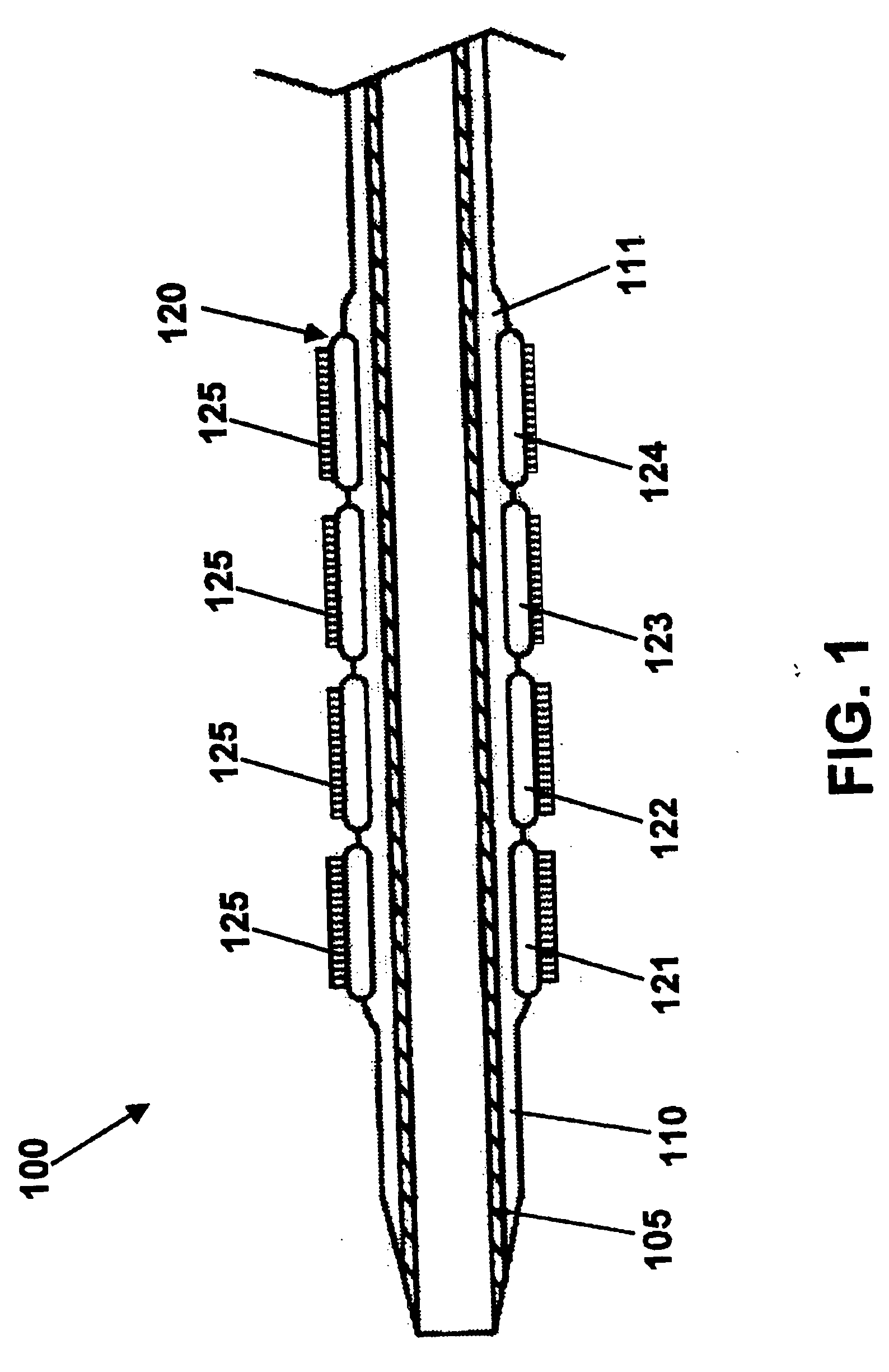 Stent with detachable ends