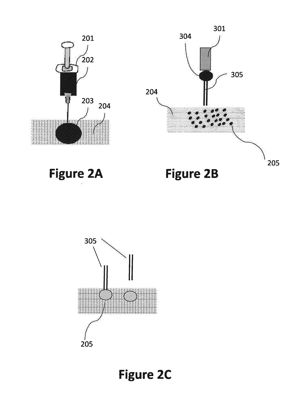 Compositions, methods and devices for local drug delivery