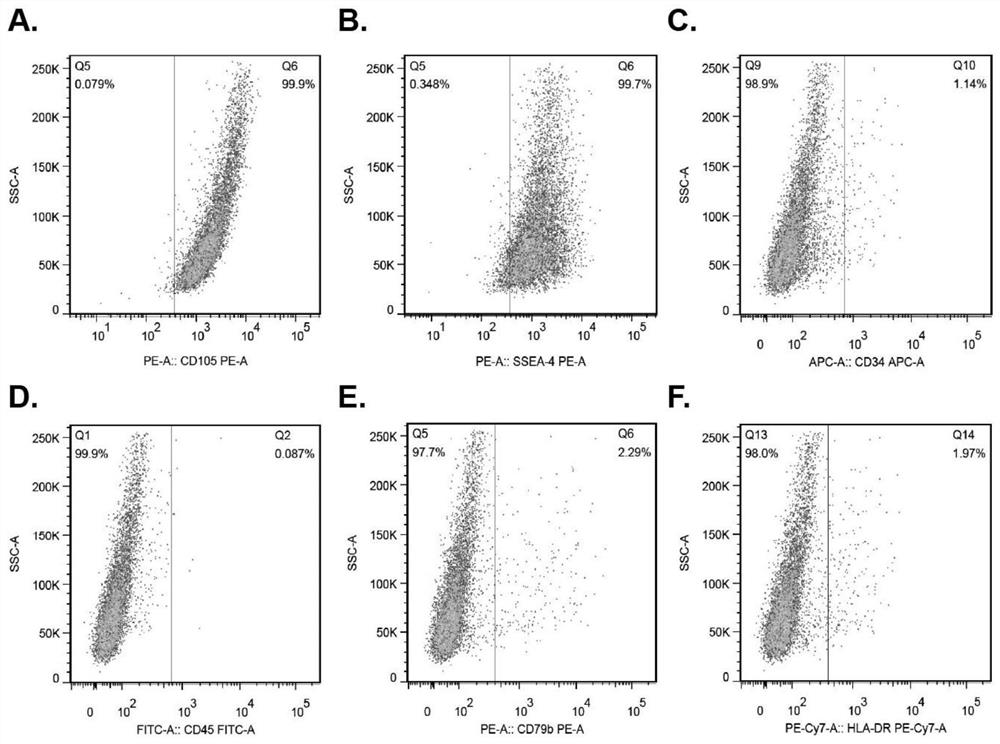 A kind of extracellular vesicle derived from human amniotic mesenchymal stem cells and its application