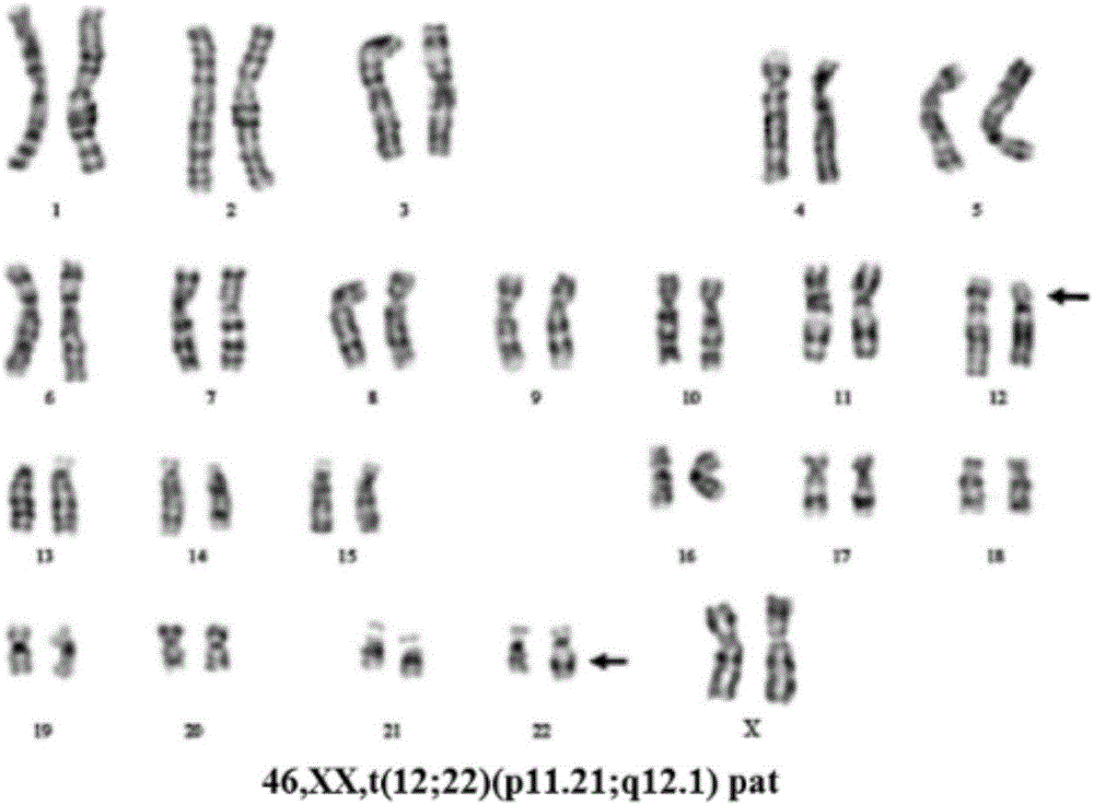 Method for identifying embryos carrying chromosomal balanced translocation and normal embryos