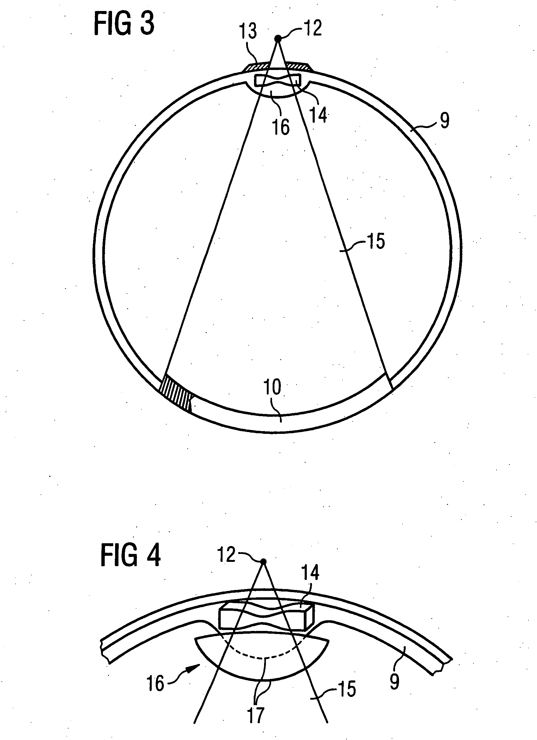 X-ray computed tomography apparatus for fast image acquisition