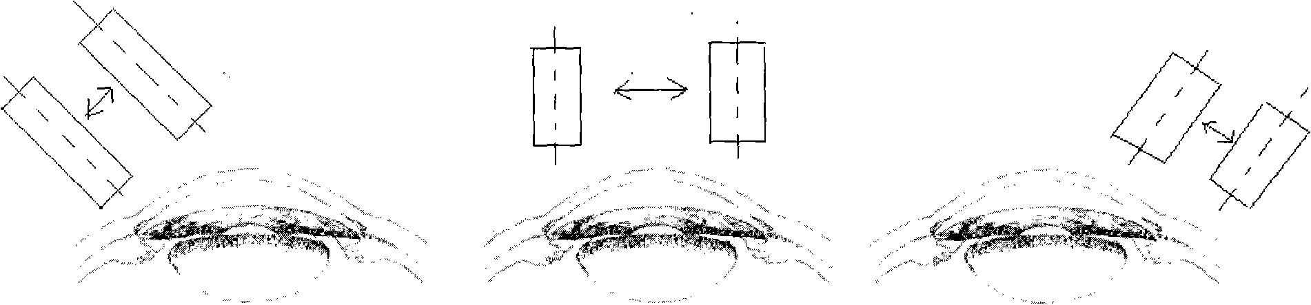 Method for panoramic imaging ophthalmology protomerite detected by ultrasound biological microscopes