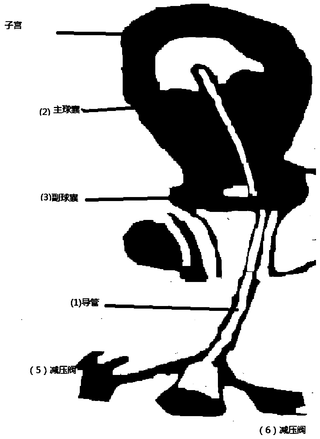 Balloon system for postpartum recovery