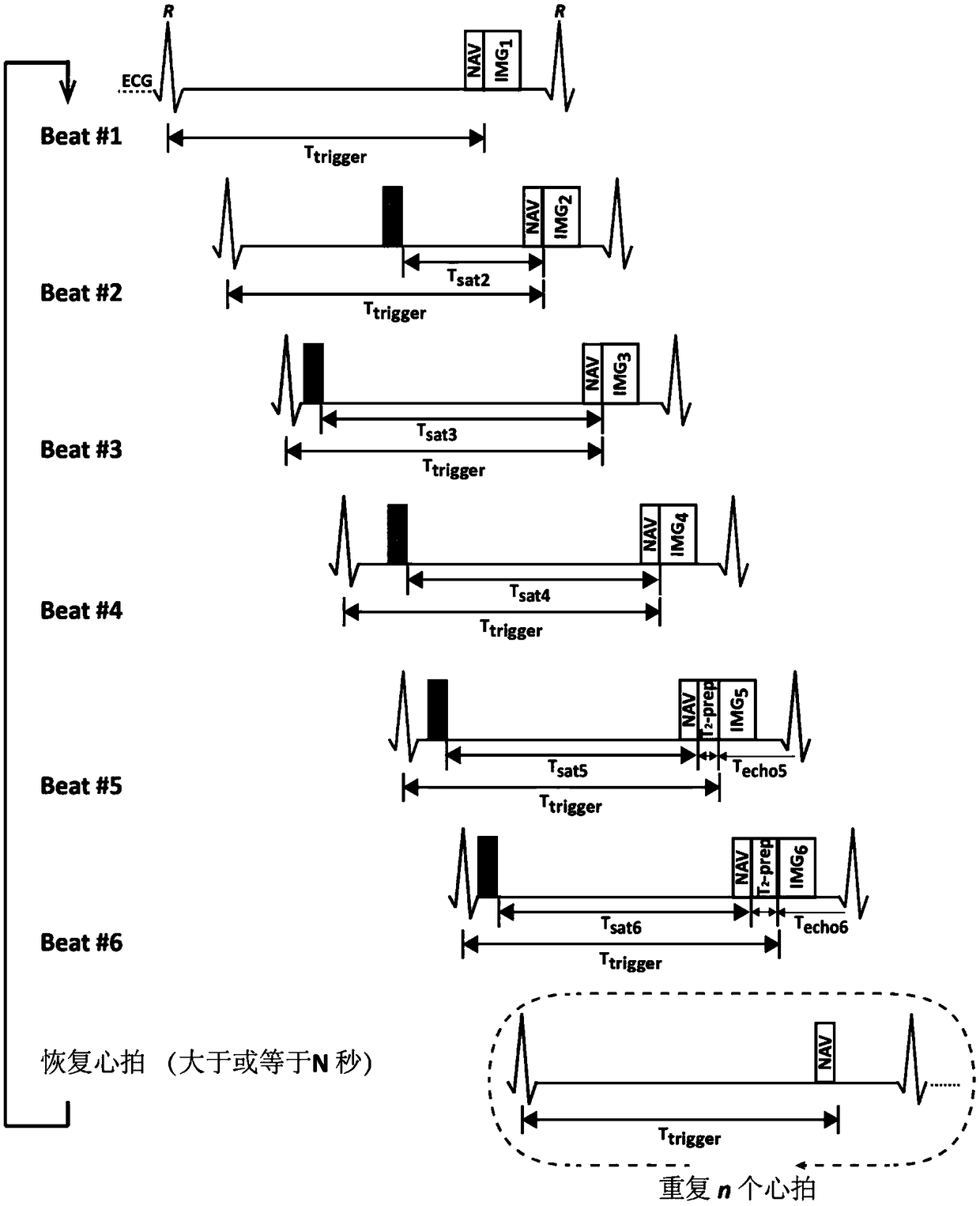 Quantitative myocardial magnetic resonance imaging method and equipment and storage medium