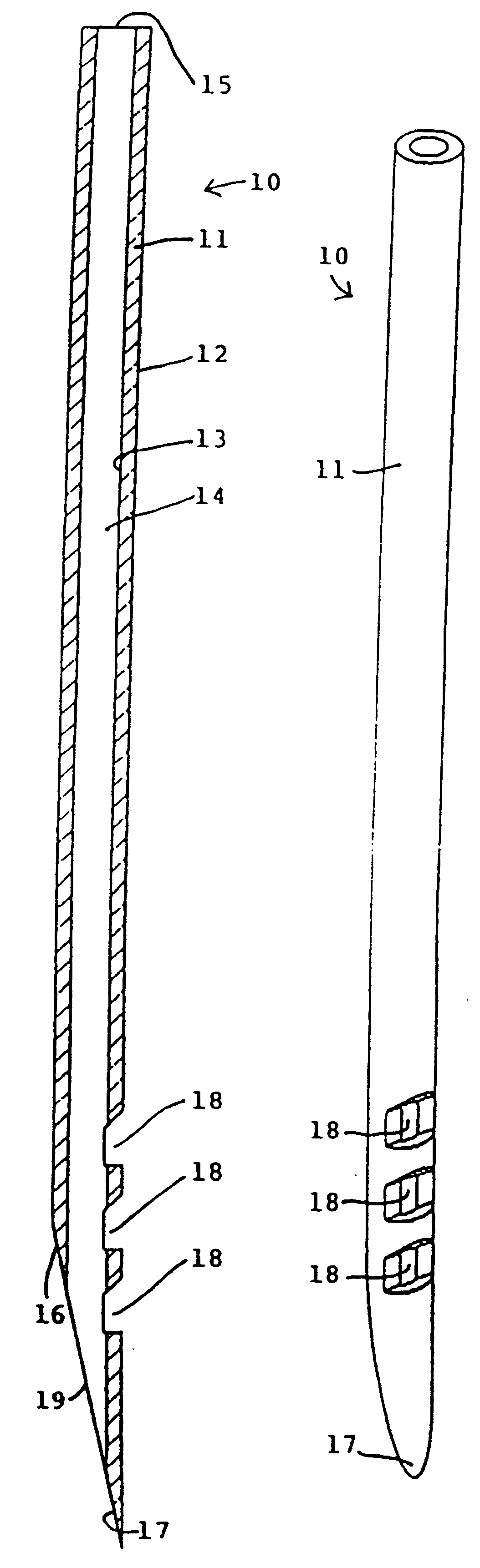 Needle and method for delivery of fluids