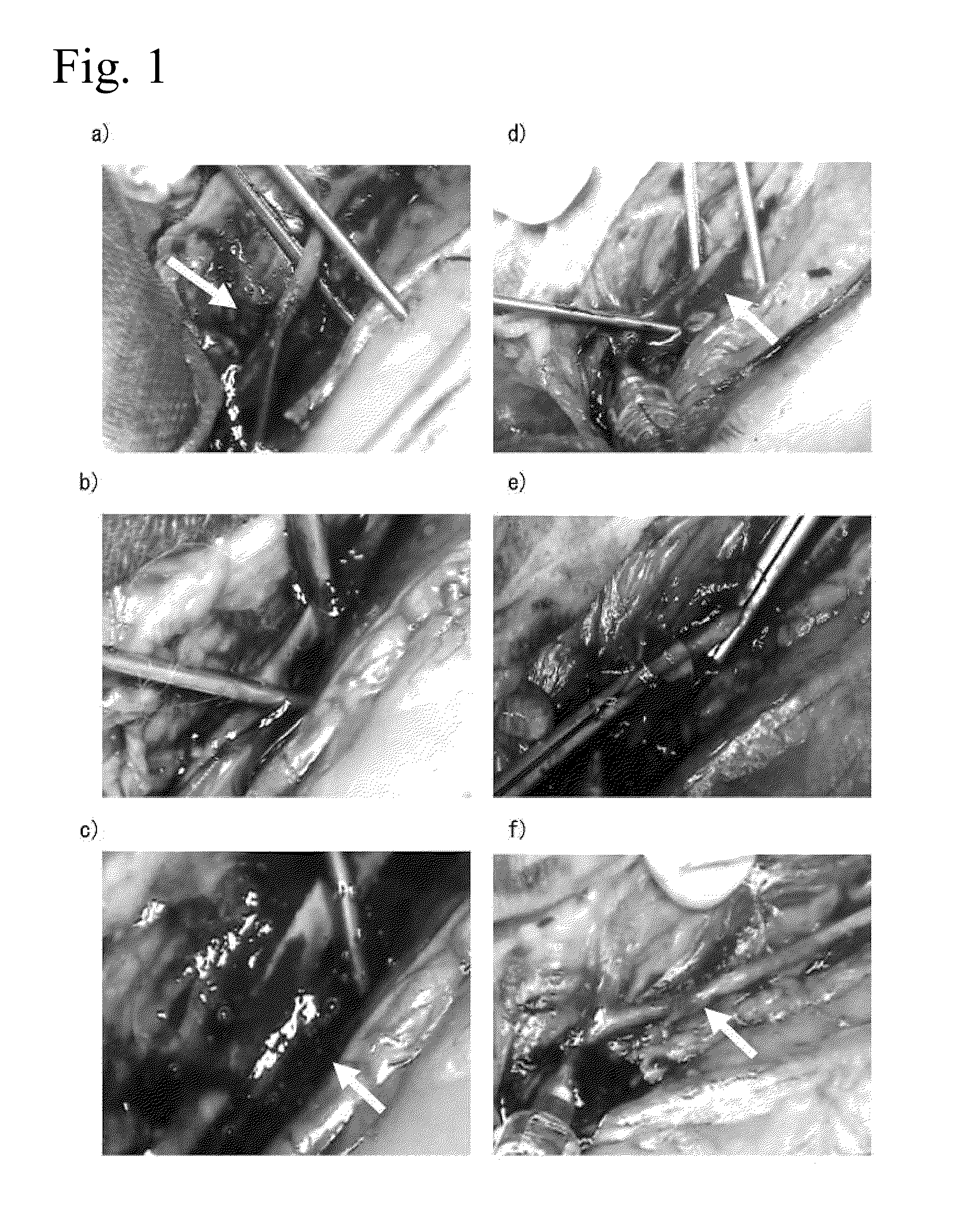 Tissue occluding agent