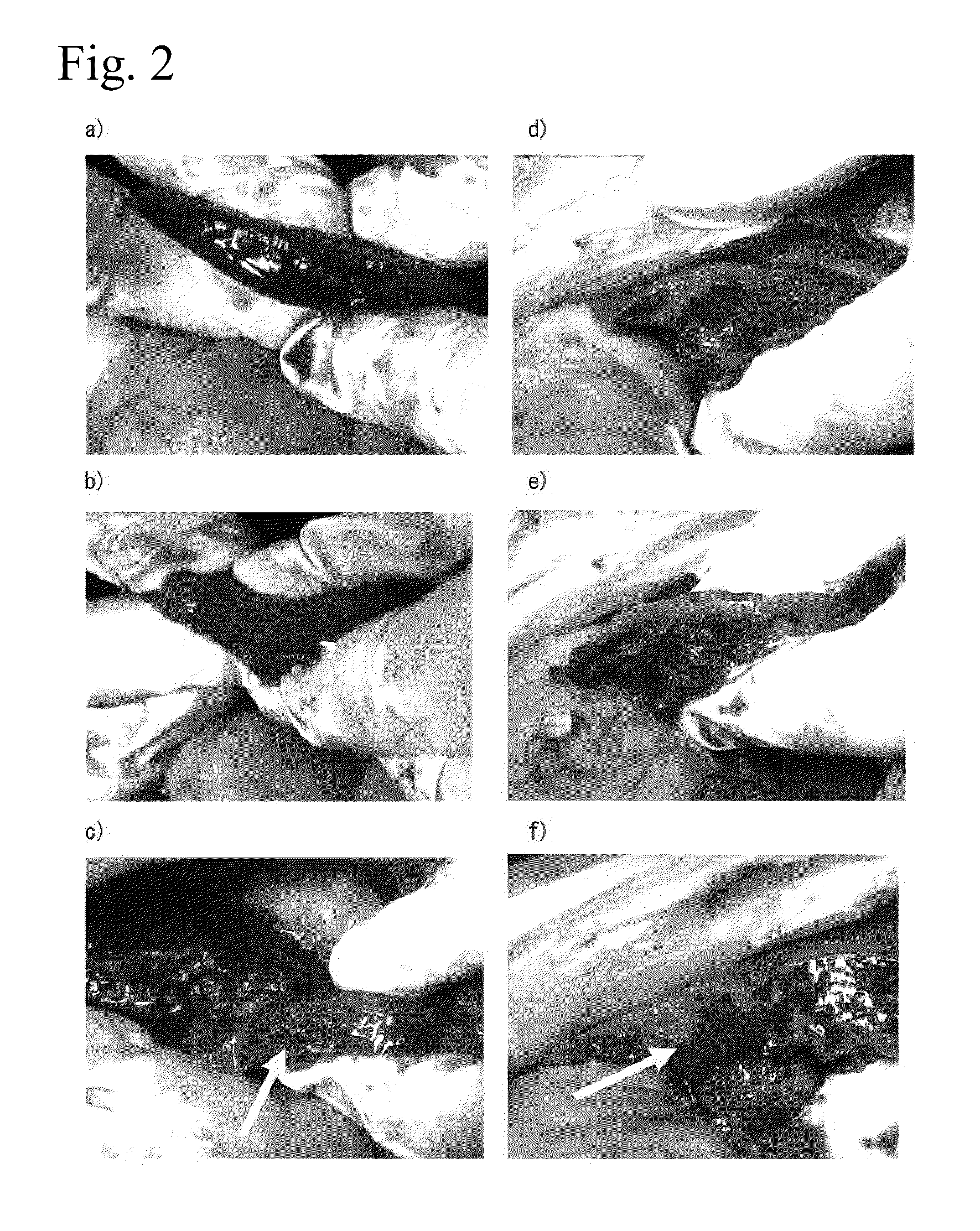 Tissue occluding agent