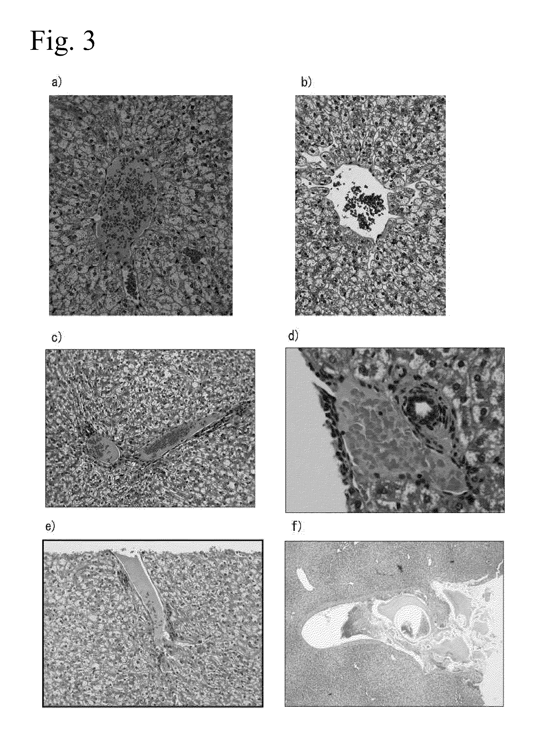 Tissue occluding agent