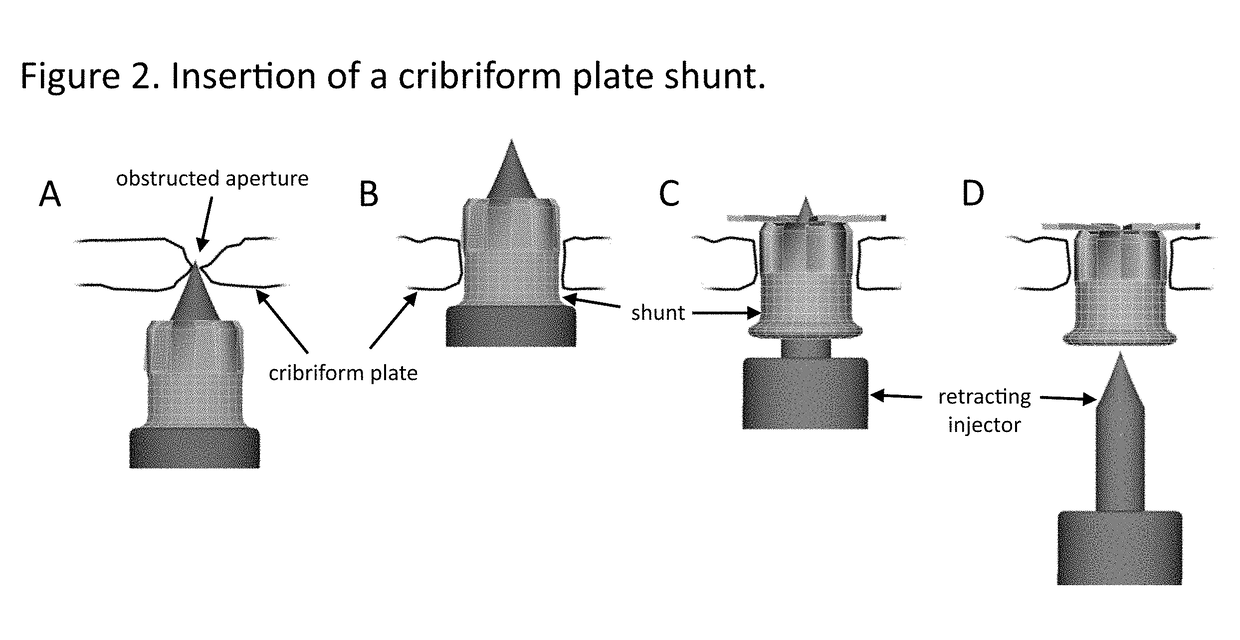 Method and use of draining fluid above the cribriform plate