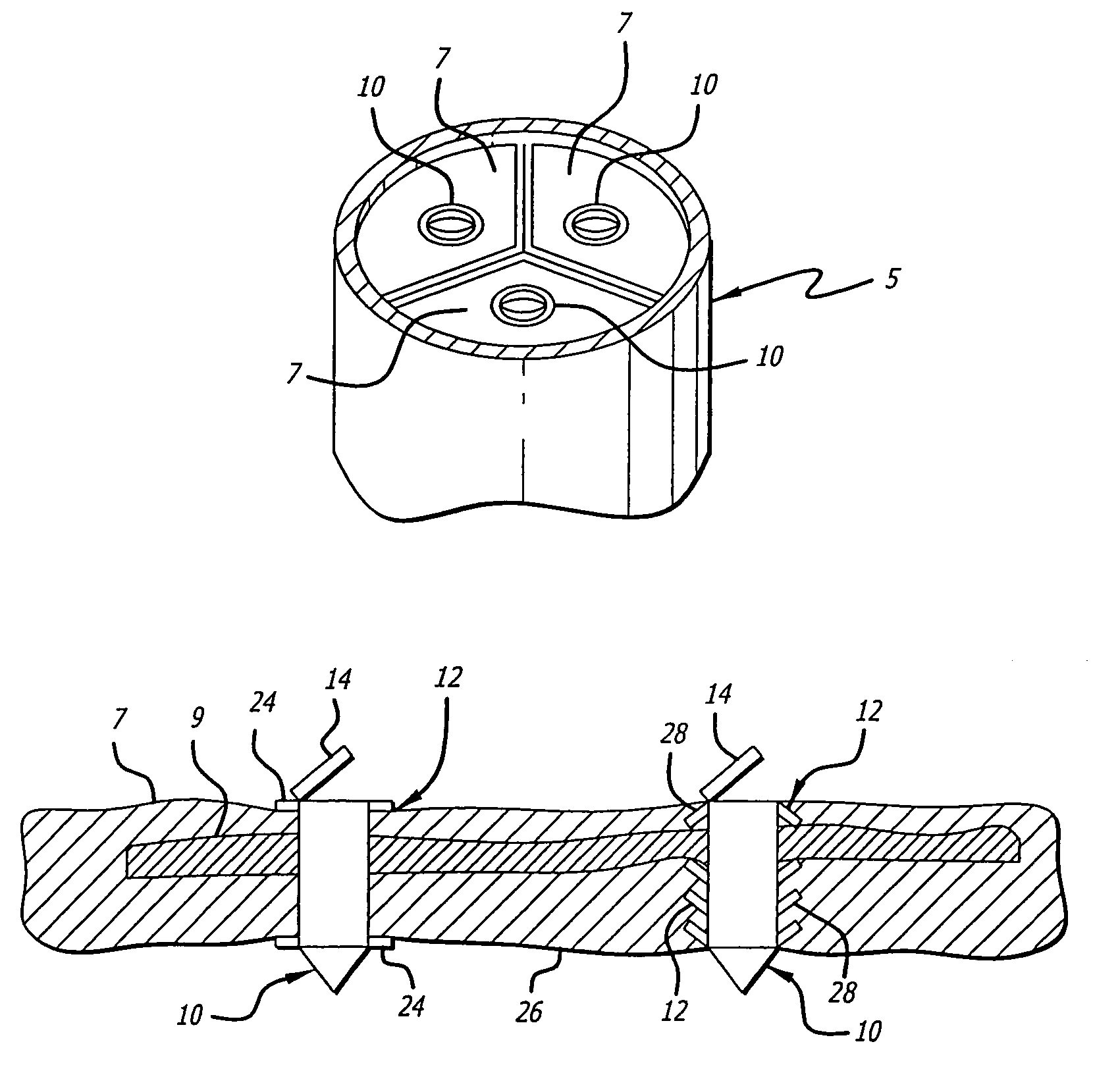 Method of treating diseased valve