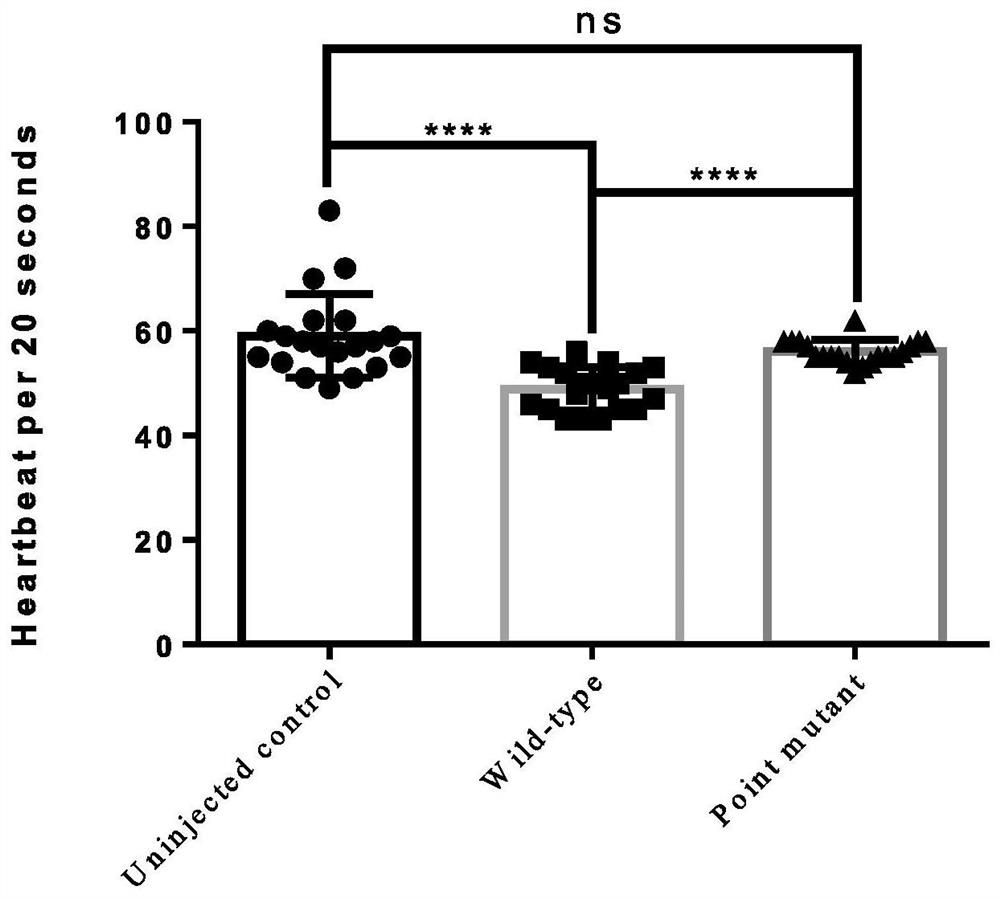 A screening kit for paroxysmal supraventricular tachycardia