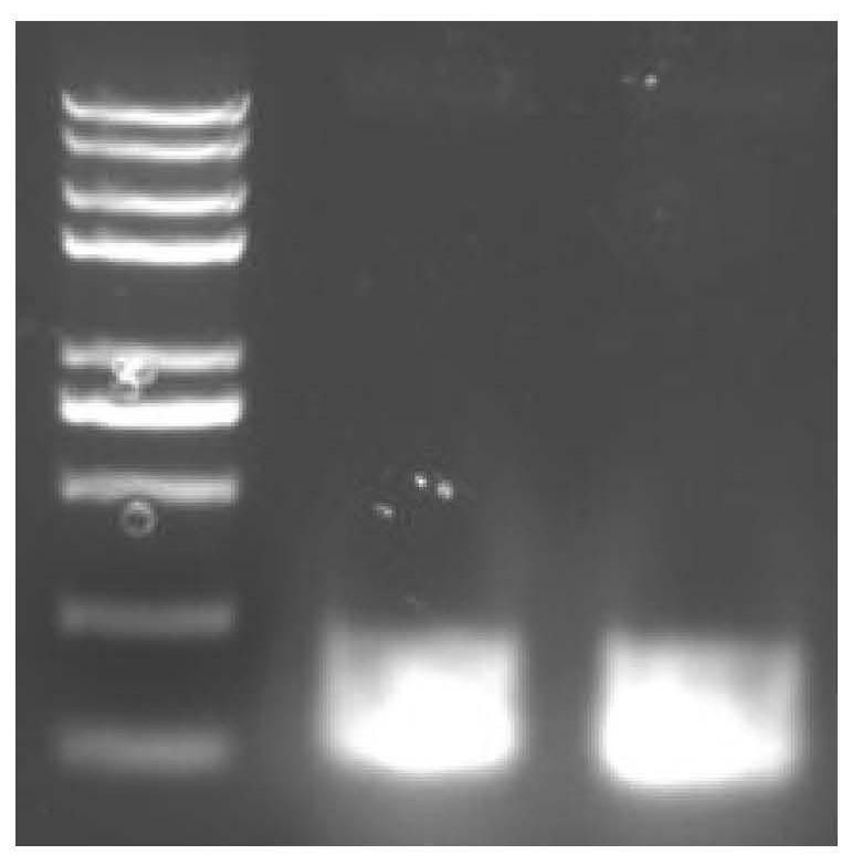 Breeding method for obtaining XX/XY sex-determined pseudo male fish parents on large scale and application thereof