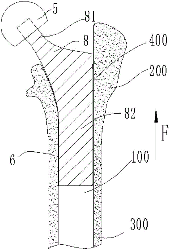 Artificial hip joint femoral stem