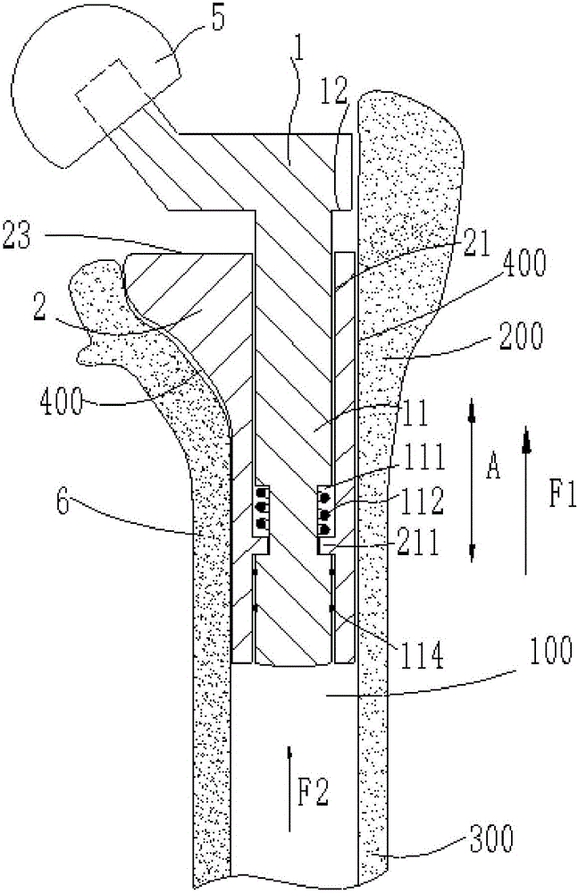 Artificial hip joint femoral stem