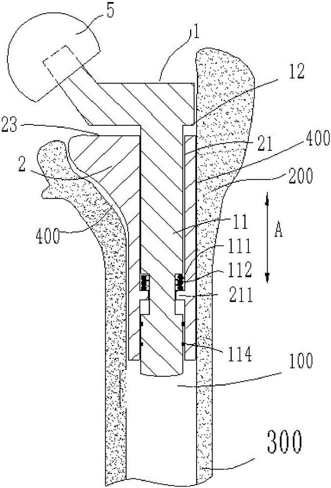 Artificial hip joint femoral stem