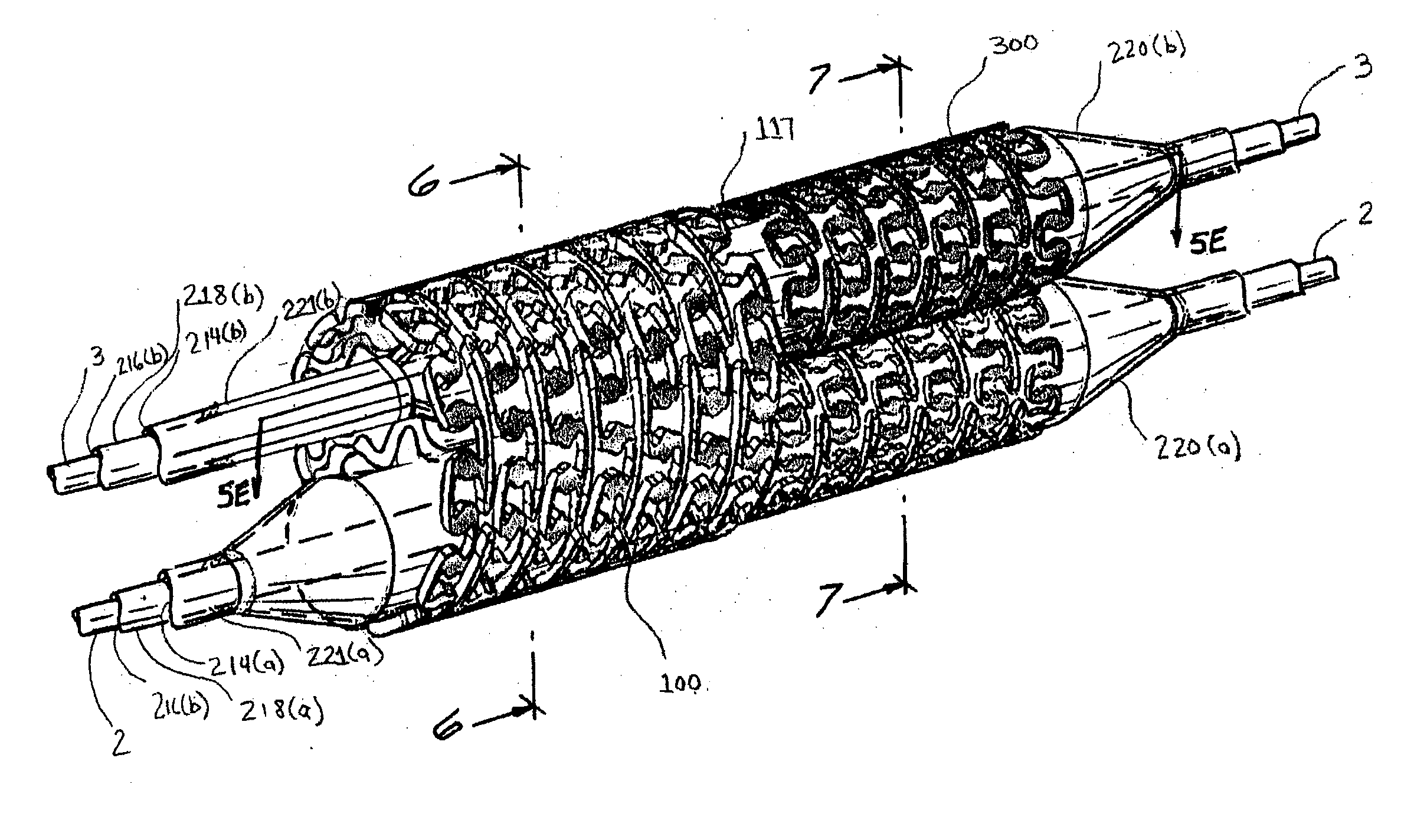 Apparatus for treating a bifurcated region of a conduit