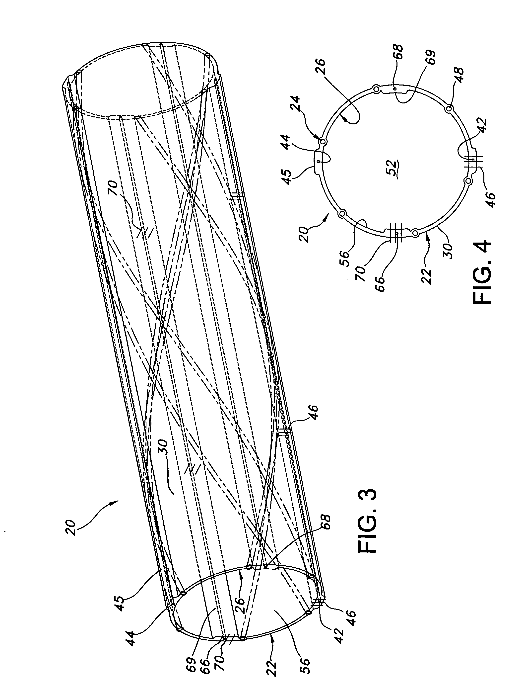 ePTFE lamination - resizing ePTFE tubing