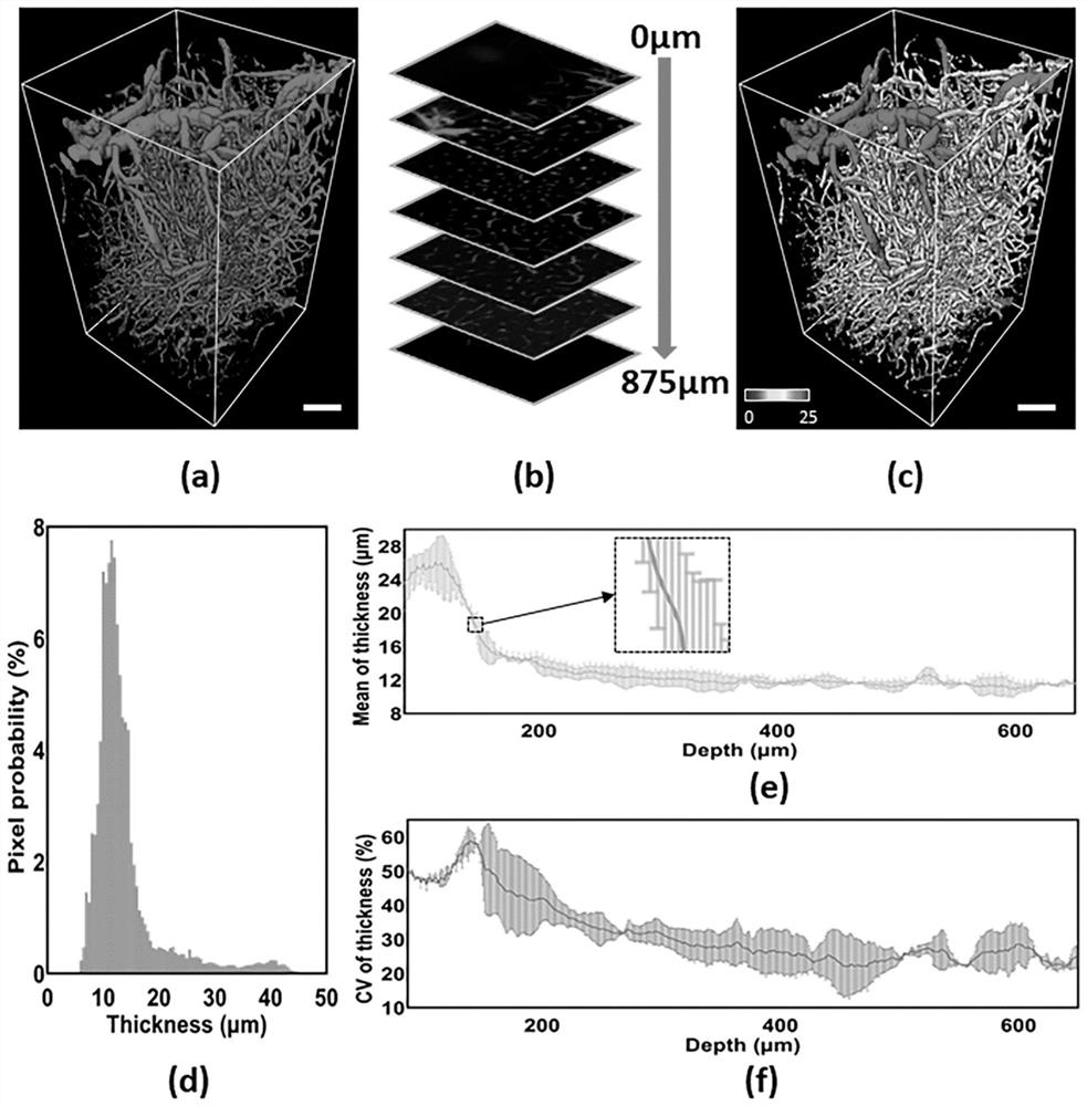 Image processing-based blood vessel diameter adaptive, pixel-level and visual quantitative characterization method