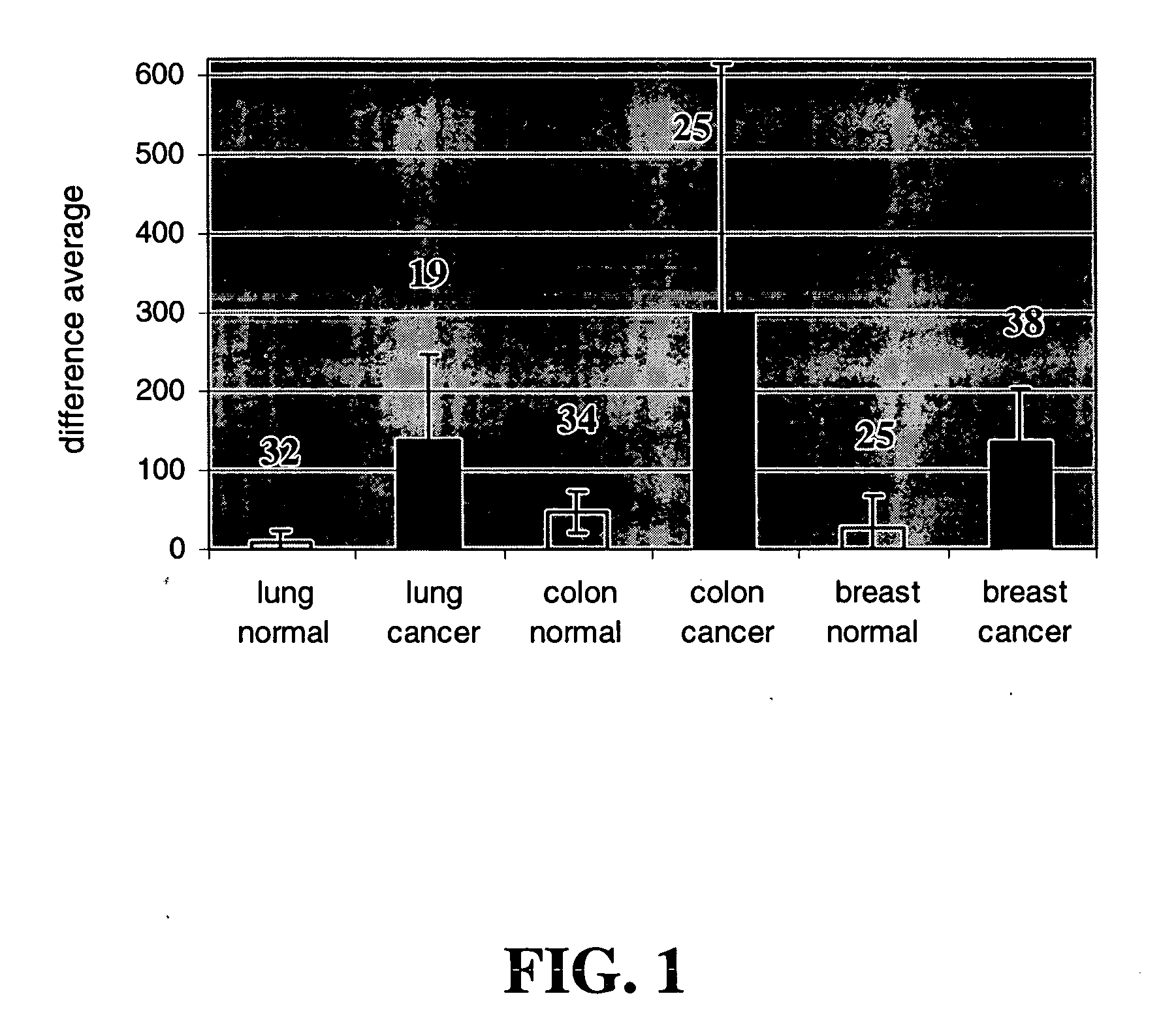 Diagnoses and therapeutics for cancer