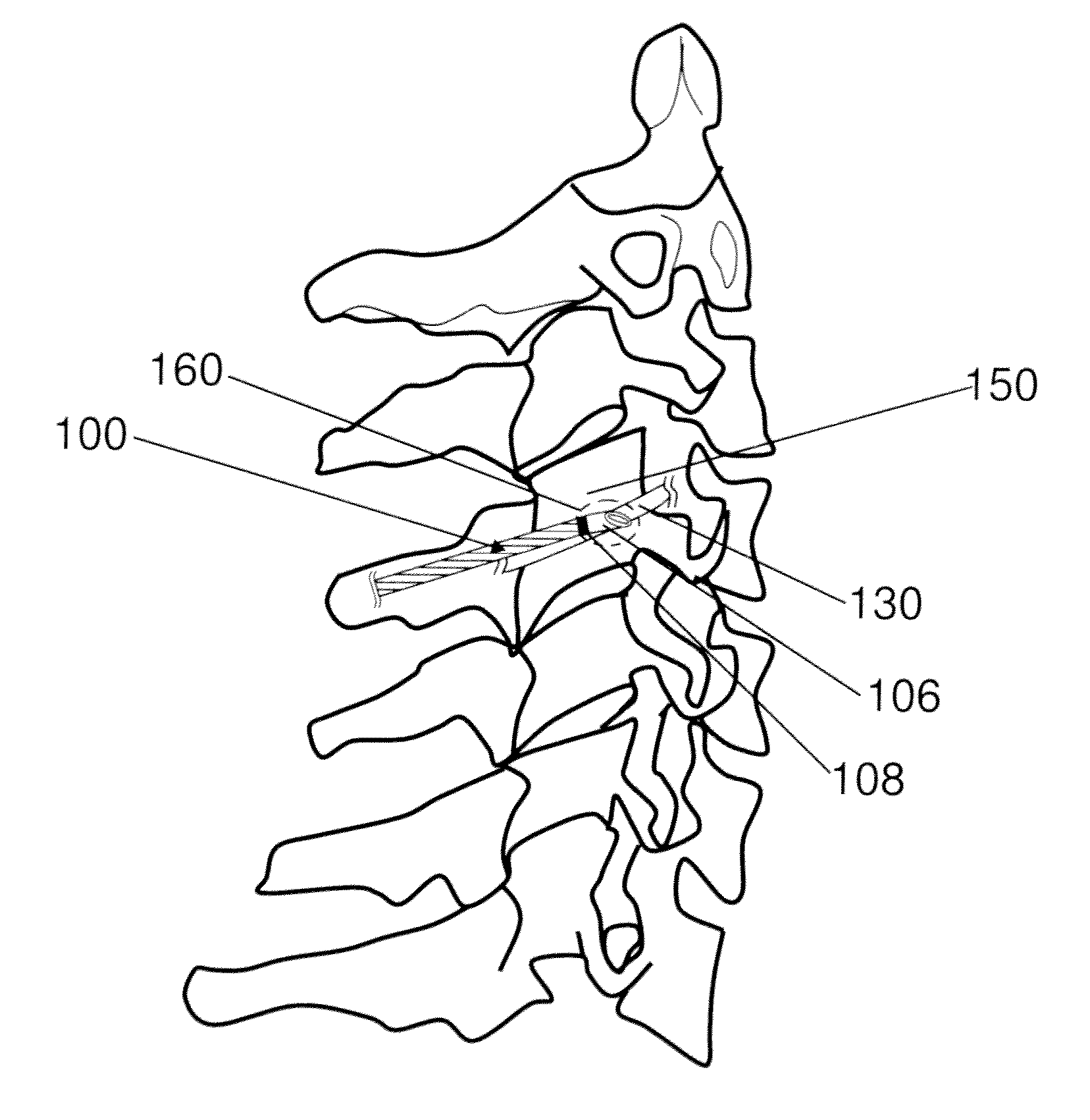 Device and method for electrosurgery