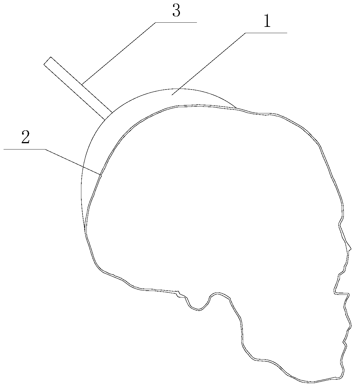 3D printed cerebral hemorrhage puncture drainage path positioning device and preparation method thereof