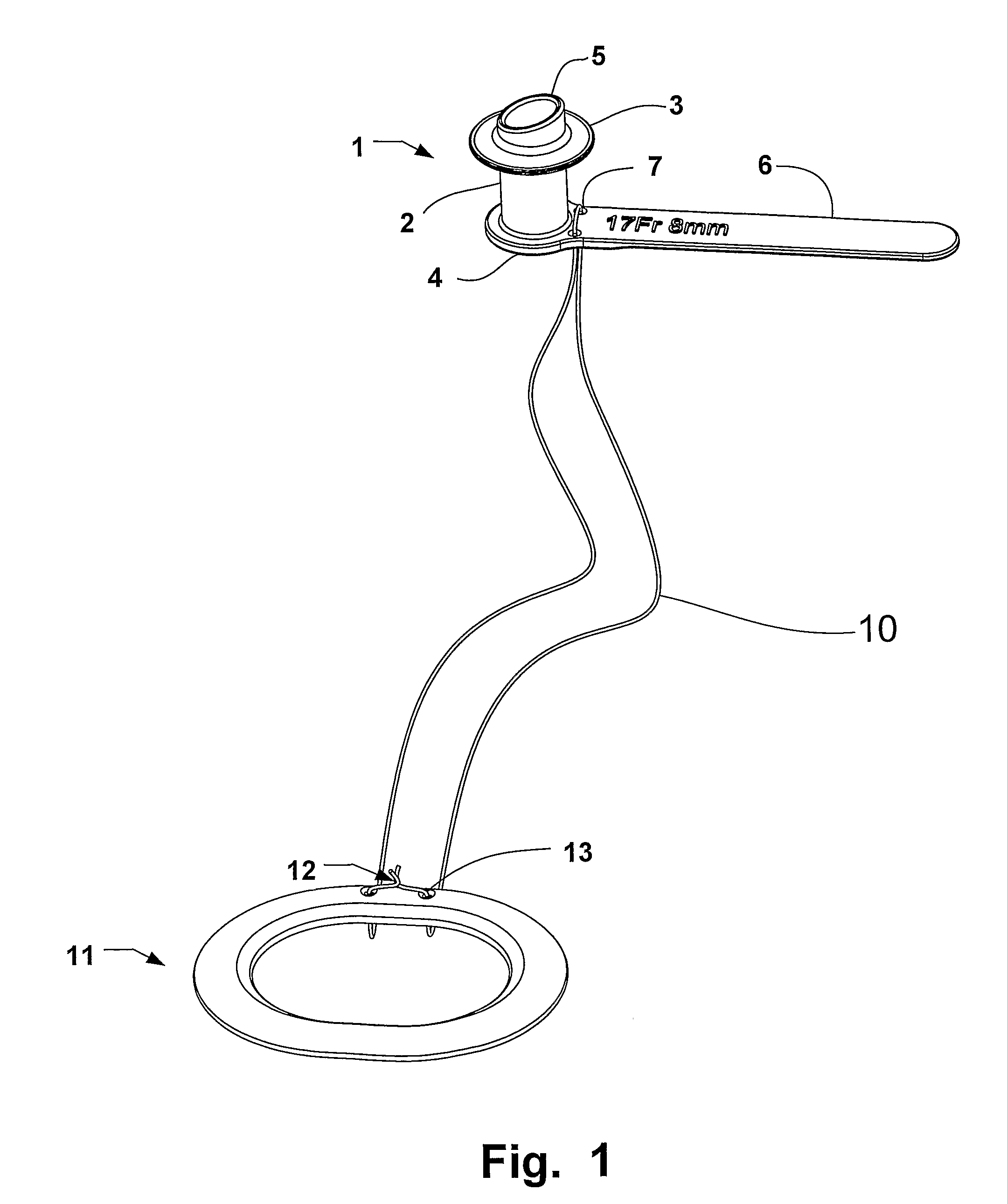 Voice prosthesis, insertion tool and method