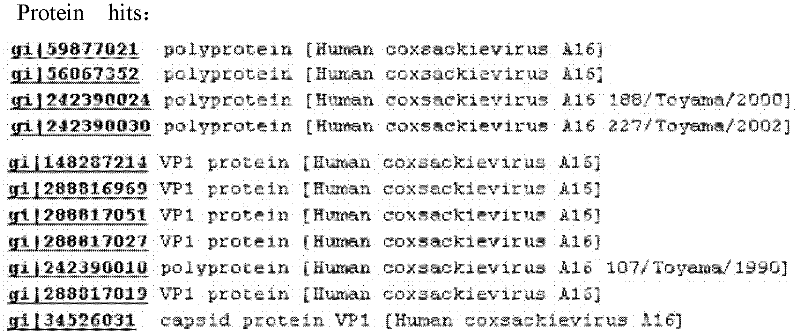 A16 type strain of Coxsackie virus and application of the strain