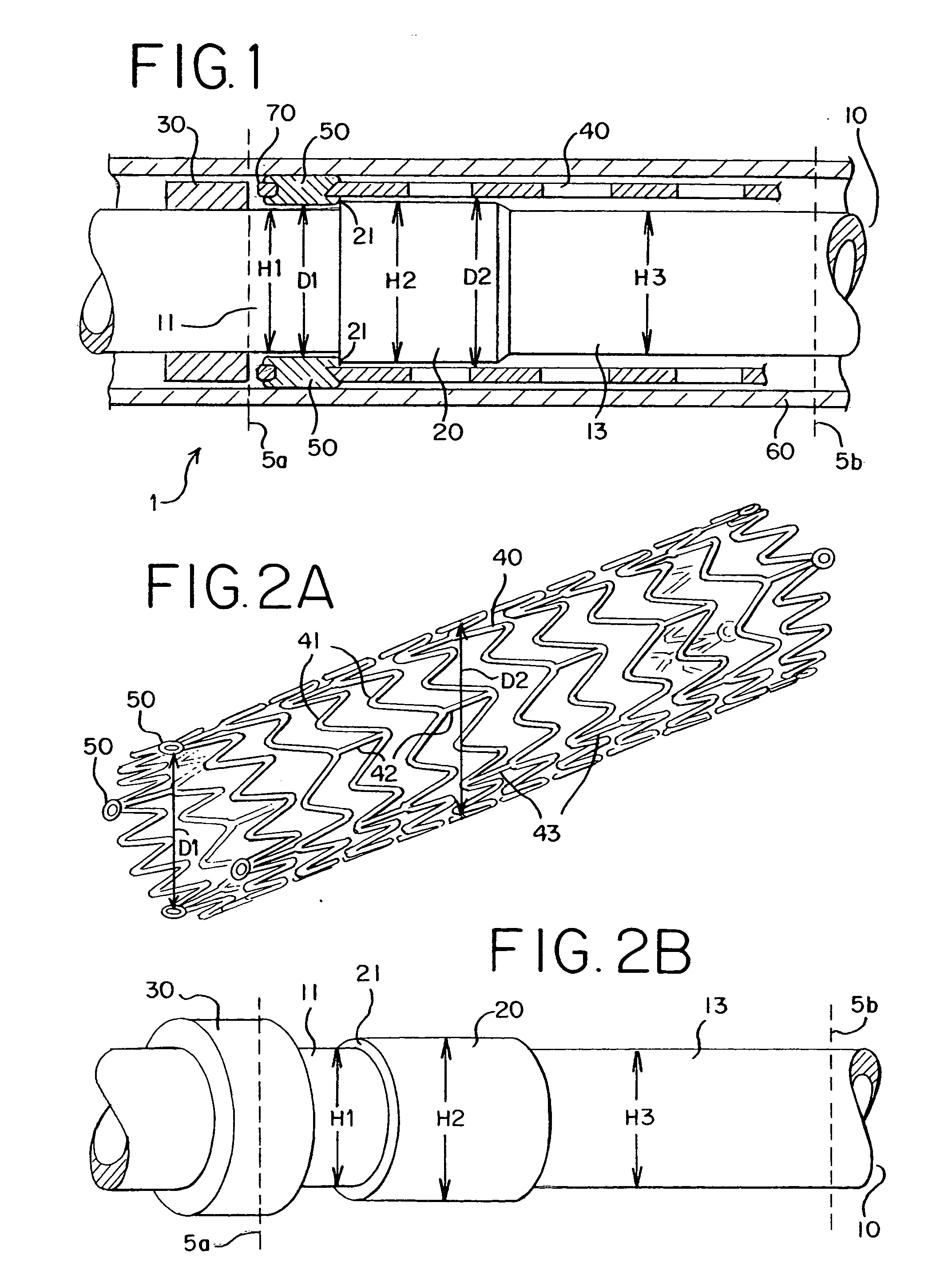 Stent delivery system allowing controlled release of a stent