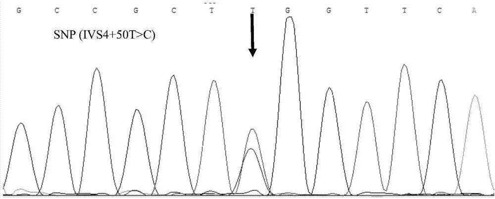 RFLP method and kit for detecting SNP locus of MEF2C gene of cattle