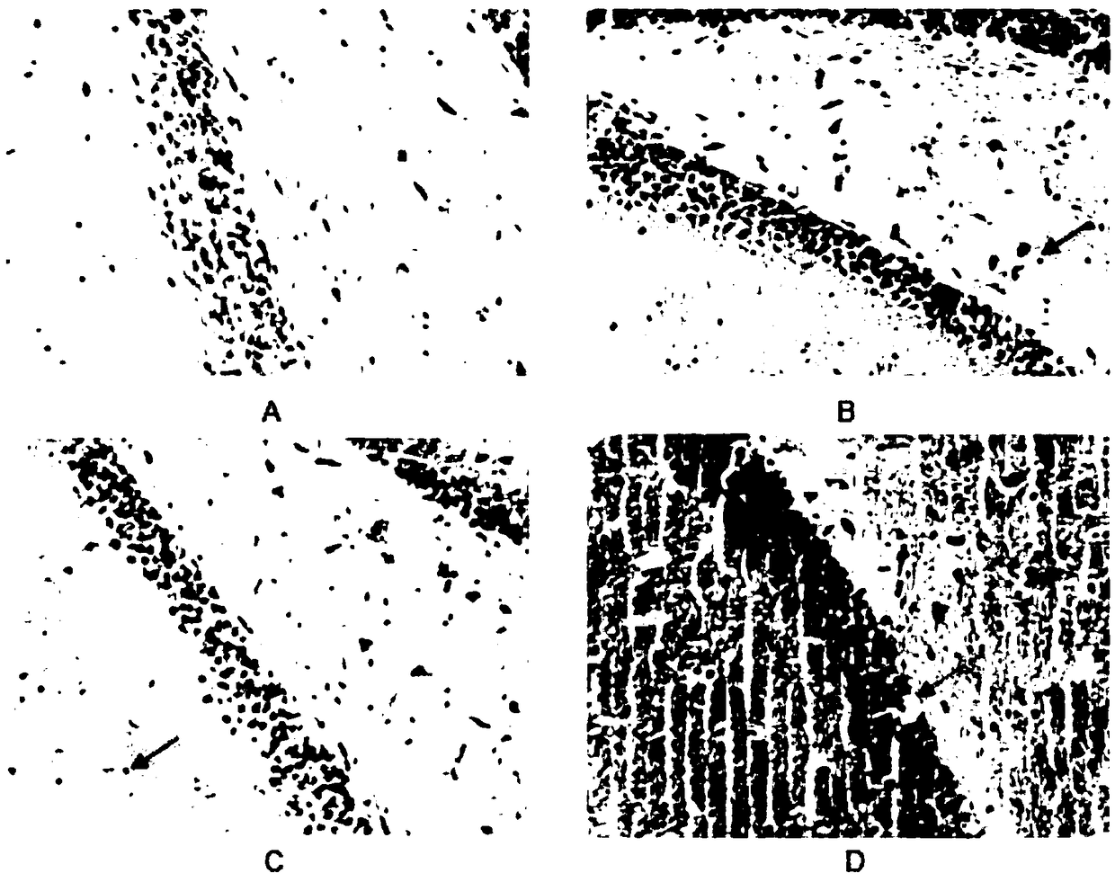 Method for establishing cognitive function injury rat animal model