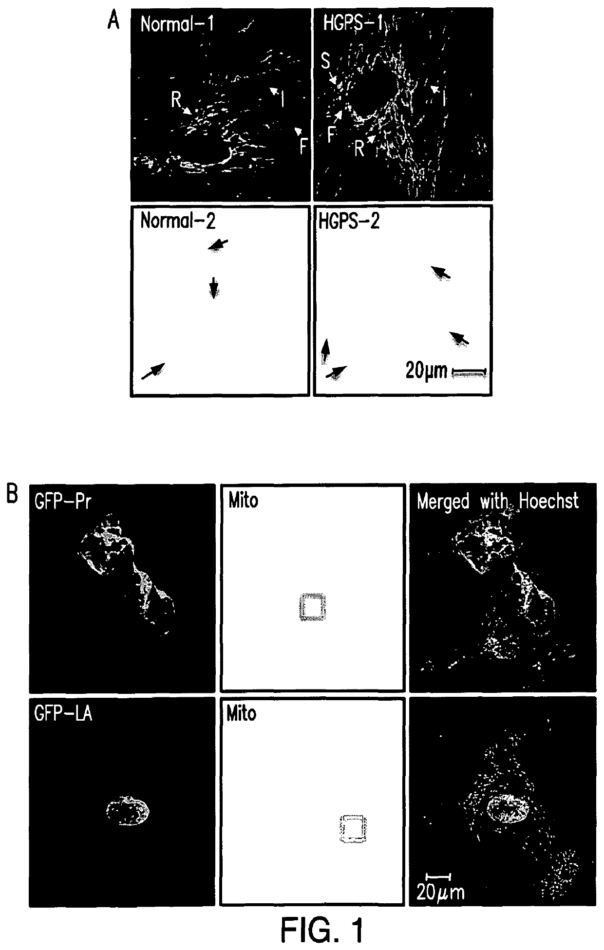 Methods of treating age-related symptoms in mammals and compositions therefor