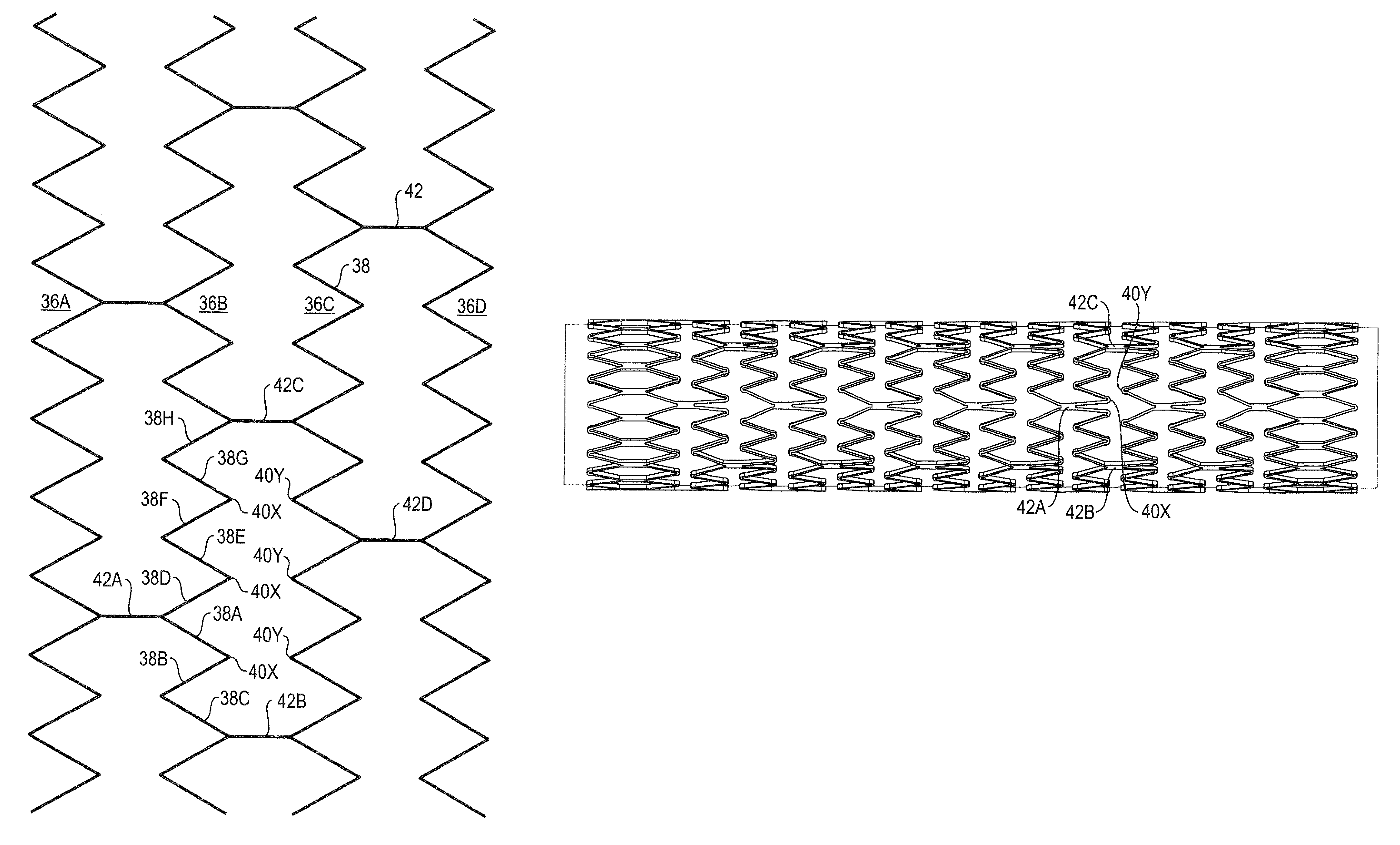 Bend-capable stent prosthesis