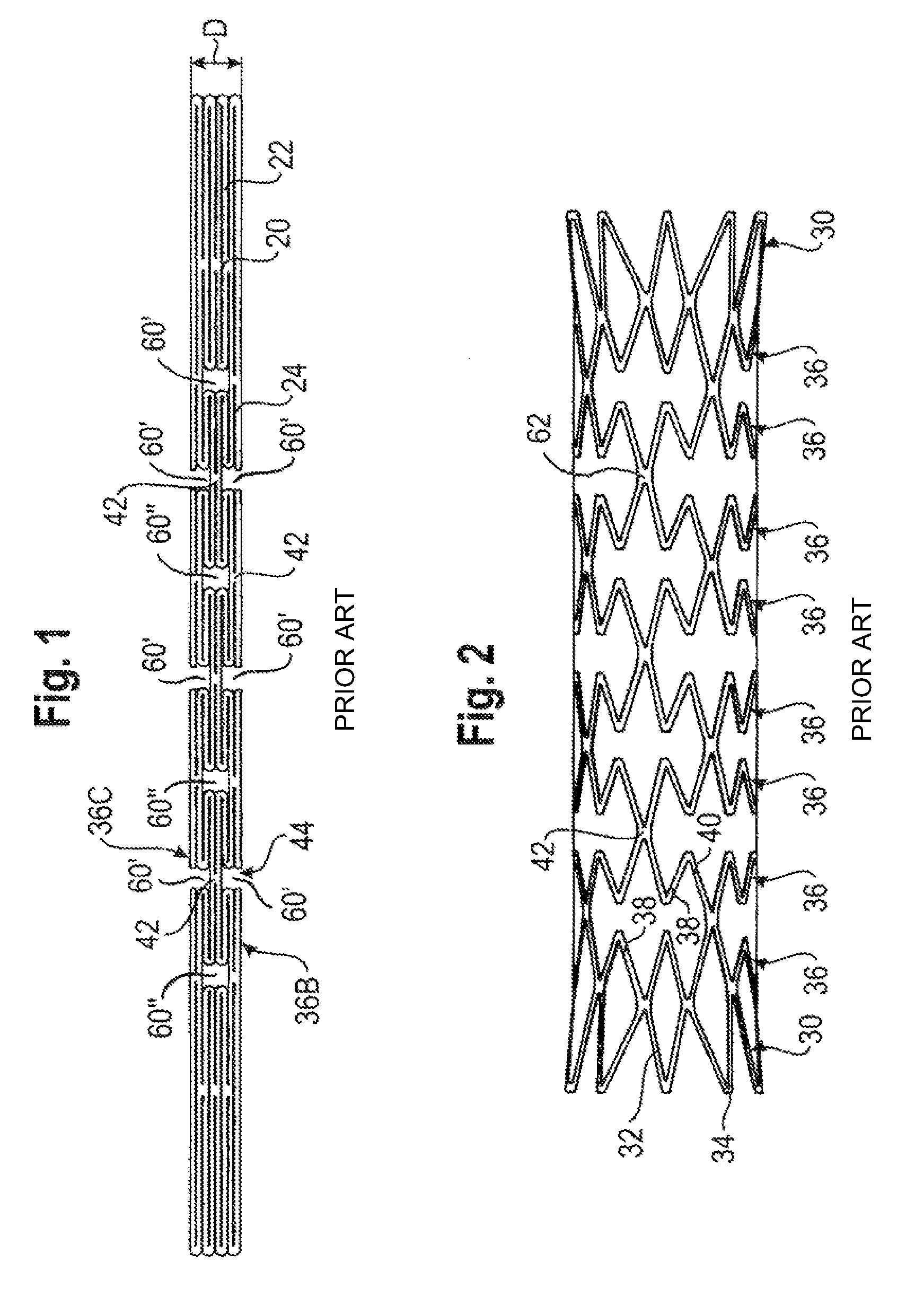 Bend-capable stent prosthesis