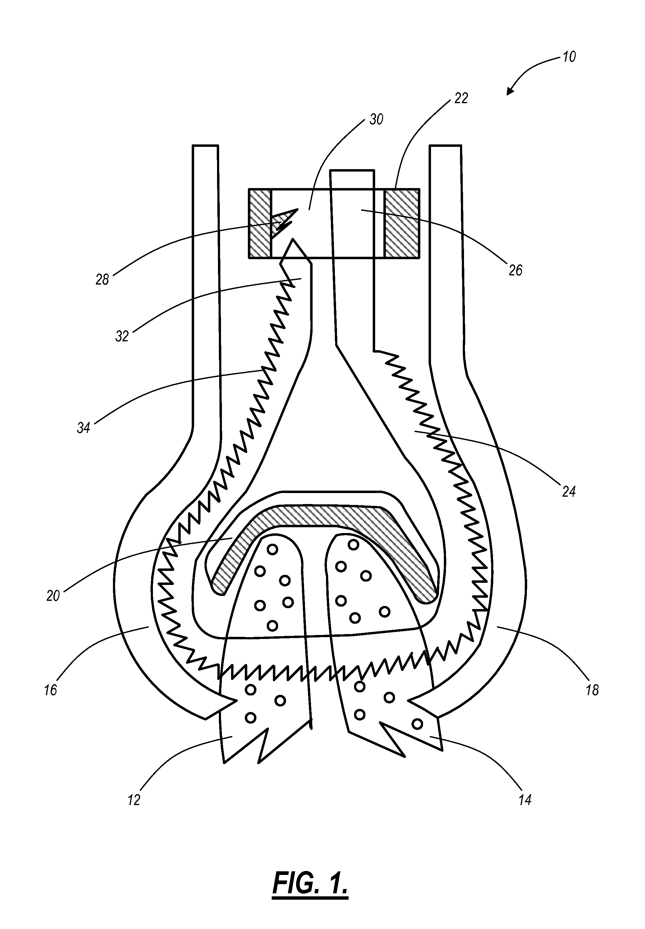 Surgical systems and methods for joint fixation