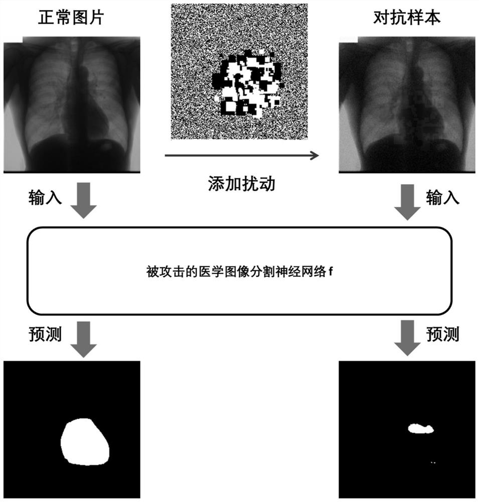 Black box attack method of medical image segmentation neural network based on query