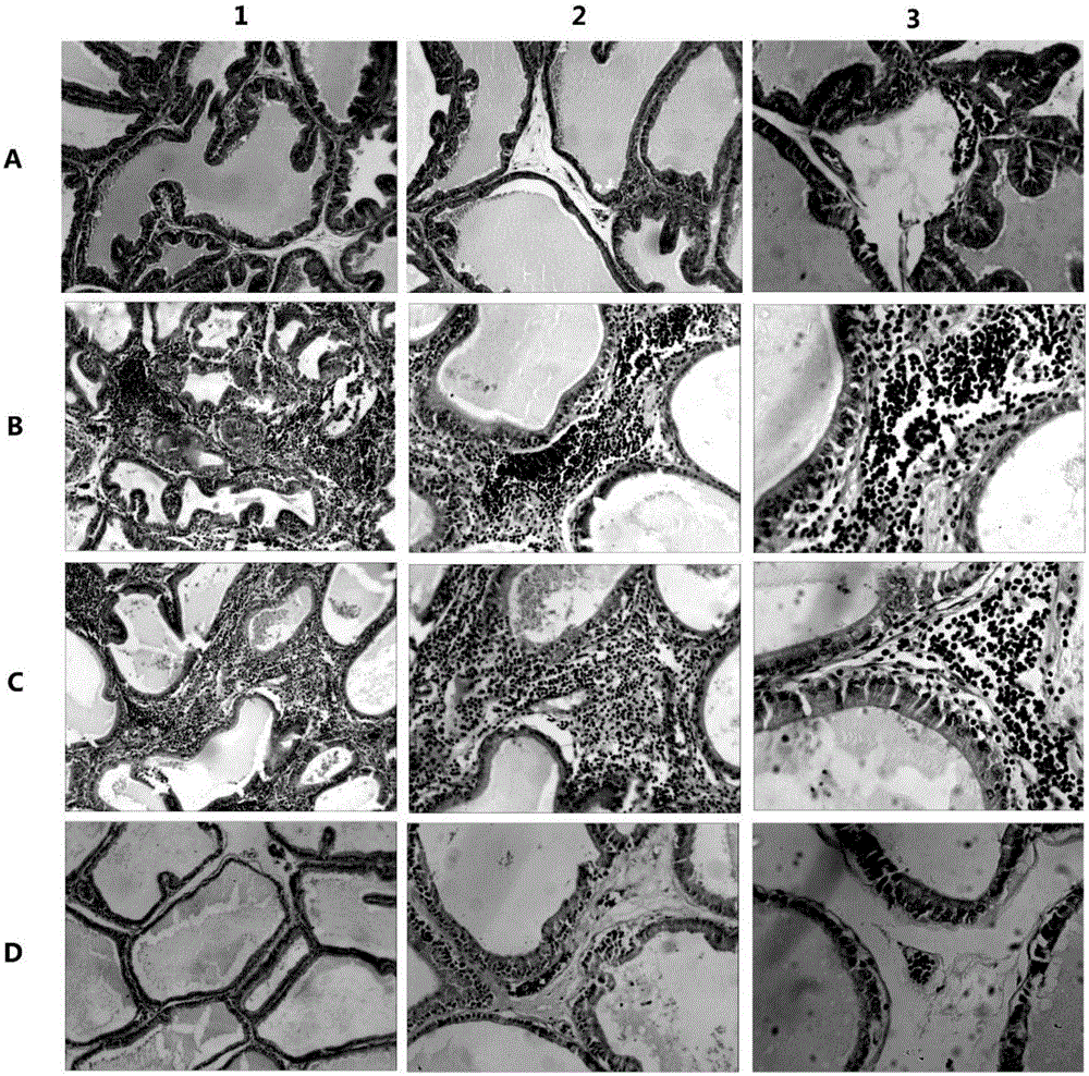 TRPM8 protein and related polypeptide fragment and new application of antibody thereof