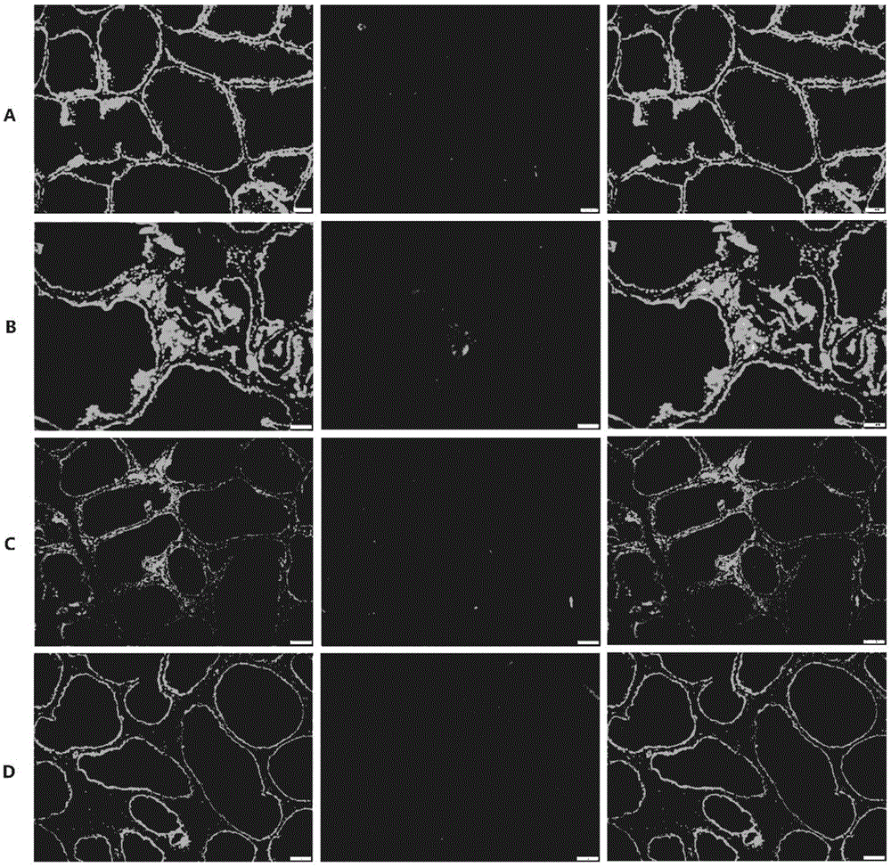 TRPM8 protein and related polypeptide fragment and new application of antibody thereof