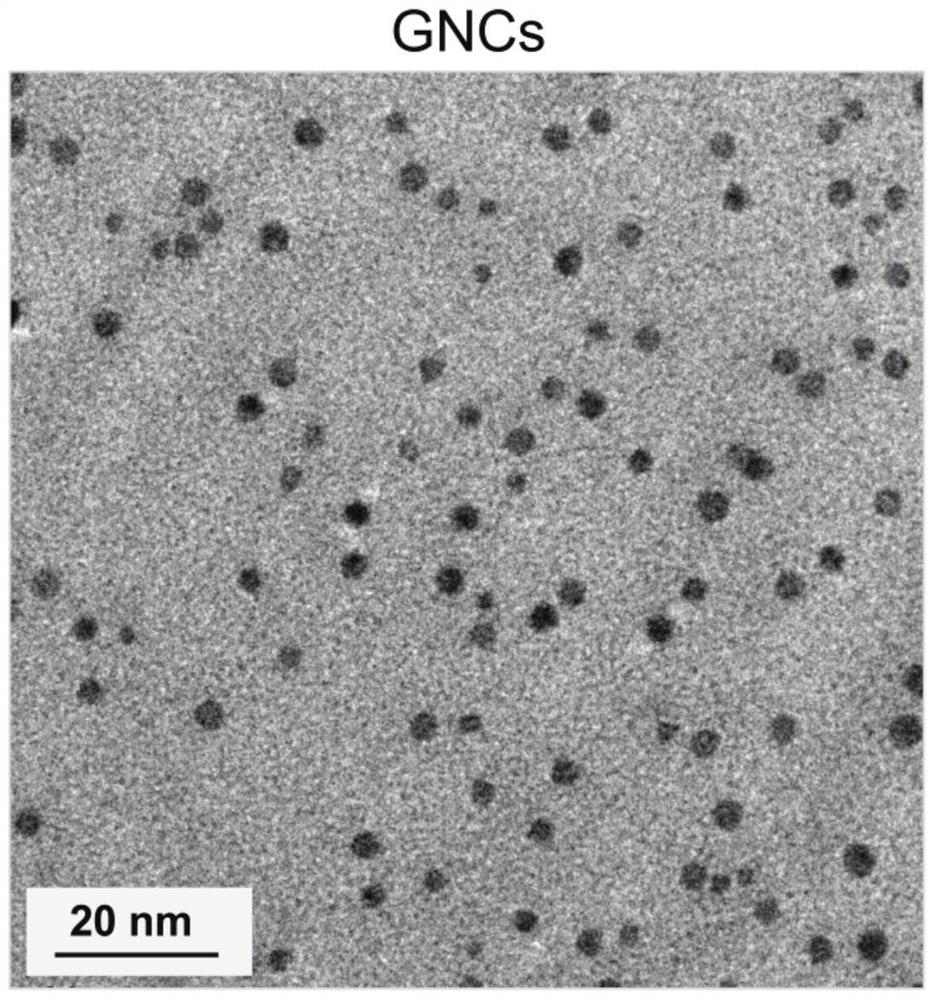 A method for the treatment of pancreatic cancer based on gold nanoclusters combined with ngf siRNA