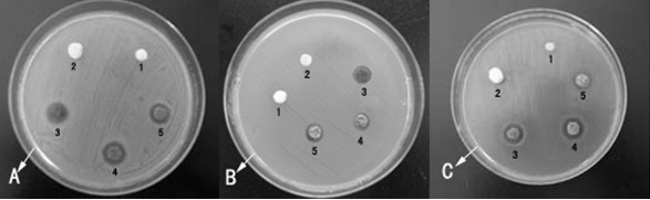 Hemostatic bacteriostatic biological dressing and preparation method thereof