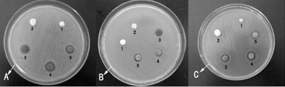 Hemostatic bacteriostatic biological dressing and preparation method thereof