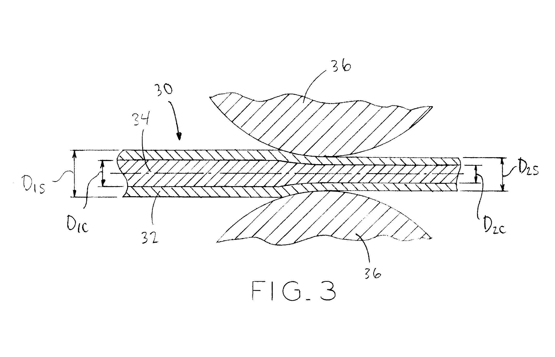 Biodegradable composite wire for medical devices