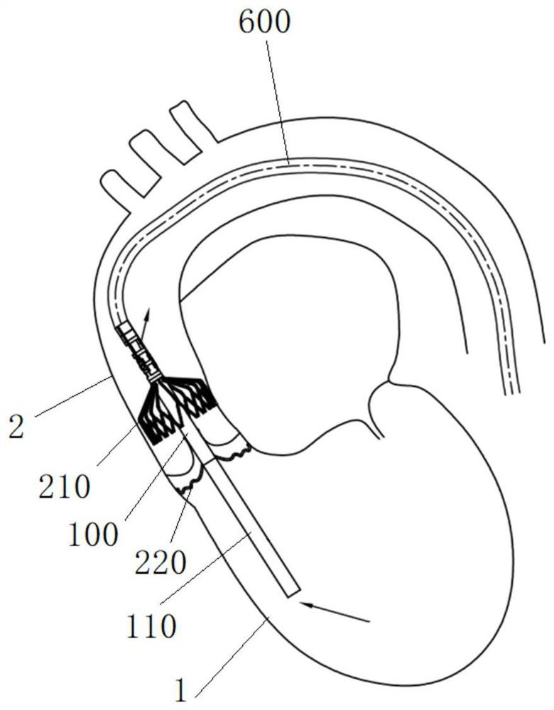 Auxiliary pump blood catheter pump