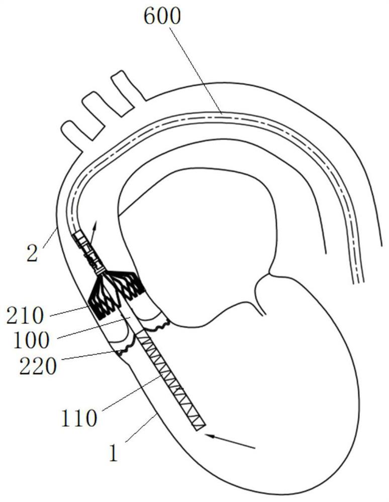 Auxiliary pump blood catheter pump